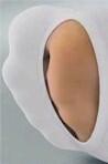 mediven ulcer kit AD open teen mt-1